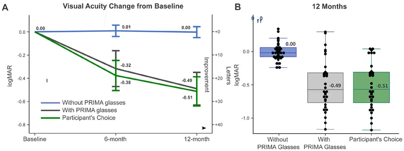 Gráficos do estudo PRIMAvera mostram a mudança da acuidade visual aos seis e doze meses, com e sem os óculos PRIMA.
